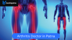 Best 5 Arthritis Doctors in Patna – Find Top Joint Pain Specialists in India