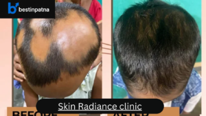 Skin Radiance Clinic – Top 5 Skin Doctor in Patna