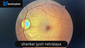 Shankar Jyoti Netralaya, Patna – Best Eye Hospital in Patna